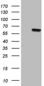 PHGDH Antibody in Western Blot (WB)