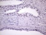 NUDT21 Antibody in Immunohistochemistry (Paraffin) (IHC (P))