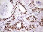 NUDT21 Antibody in Immunohistochemistry (Paraffin) (IHC (P))