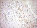 CTGF Antibody in Immunohistochemistry (Paraffin) (IHC (P))