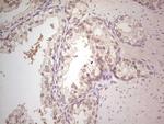 Hairless Antibody in Immunohistochemistry (Paraffin) (IHC (P))