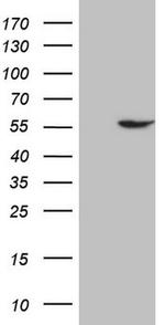 ABAT Antibody in Western Blot (WB)