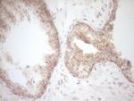 DVL2 Antibody in Immunohistochemistry (Paraffin) (IHC (P))