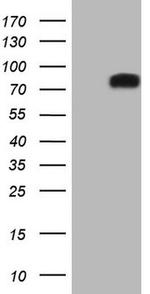 DVL2 Antibody in Western Blot (WB)