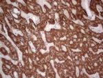 ABAT Antibody in Immunohistochemistry (Paraffin) (IHC (P))