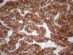 ABAT Antibody in Immunohistochemistry (Paraffin) (IHC (P))