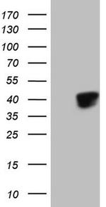 KLF2 Antibody in Western Blot (WB)