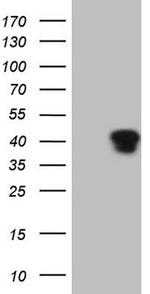 KLF2 Antibody in Western Blot (WB)