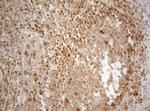 ALOX5 Antibody in Immunohistochemistry (Paraffin) (IHC (P))