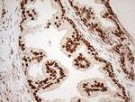 ALOX5 Antibody in Immunohistochemistry (Paraffin) (IHC (P))