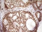 HMG20A Antibody in Immunohistochemistry (Paraffin) (IHC (P))