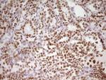 HMG20A Antibody in Immunohistochemistry (Paraffin) (IHC (P))