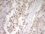 HMG20A Antibody in Immunohistochemistry (Paraffin) (IHC (P))