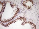 HMG20A Antibody in Immunohistochemistry (Paraffin) (IHC (P))