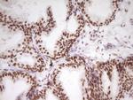 HMG20A Antibody in Immunohistochemistry (Paraffin) (IHC (P))