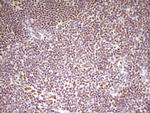 HMG20A Antibody in Immunohistochemistry (Paraffin) (IHC (P))