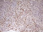 HMG20A Antibody in Immunohistochemistry (Paraffin) (IHC (P))