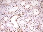 HMG20A Antibody in Immunohistochemistry (Paraffin) (IHC (P))