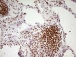 HMG20A Antibody in Immunohistochemistry (Paraffin) (IHC (P))