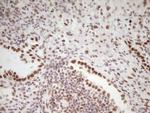 HMG20A Antibody in Immunohistochemistry (Paraffin) (IHC (P))