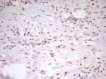 HMG20A Antibody in Immunohistochemistry (Paraffin) (IHC (P))