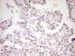 HMG20A Antibody in Immunohistochemistry (Paraffin) (IHC (P))