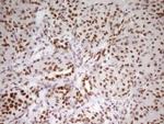 HMG20A Antibody in Immunohistochemistry (Paraffin) (IHC (P))