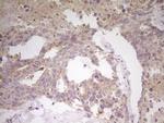 CITED1 Antibody in Immunohistochemistry (Paraffin) (IHC (P))