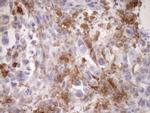 Carboxypeptidase M Antibody in Immunohistochemistry (Paraffin) (IHC (P))