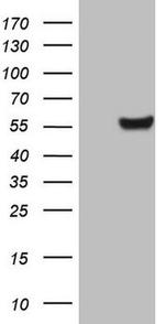 Carboxypeptidase M Antibody in Western Blot (WB)