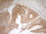 PAK4 Antibody in Immunohistochemistry (Paraffin) (IHC (P))