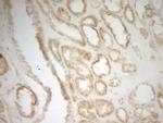 MRPL15 Antibody in Immunohistochemistry (Paraffin) (IHC (P))