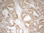 MRPL15 Antibody in Immunohistochemistry (Paraffin) (IHC (P))