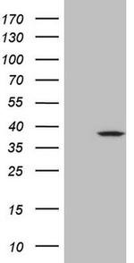 MRPL15 Antibody in Western Blot (WB)