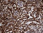 Carboxypeptidase M Antibody in Immunohistochemistry (Paraffin) (IHC (P))