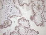 HSF2 Antibody in Immunohistochemistry (Paraffin) (IHC (P))