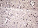 HSF2 Antibody in Immunohistochemistry (Paraffin) (IHC (P))