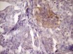 LOXL2 Antibody in Immunohistochemistry (Paraffin) (IHC (P))