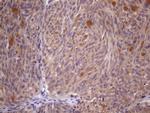 SSX2IP Antibody in Immunohistochemistry (Paraffin) (IHC (P))