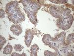 SSX2IP Antibody in Immunohistochemistry (Paraffin) (IHC (P))