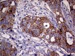 MRPL15 Antibody in Immunohistochemistry (Paraffin) (IHC (P))