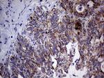 MRPL15 Antibody in Immunohistochemistry (Paraffin) (IHC (P))