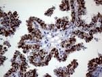 MRPL15 Antibody in Immunohistochemistry (Paraffin) (IHC (P))