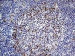 MRPL15 Antibody in Immunohistochemistry (Paraffin) (IHC (P))