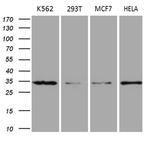 MRPL15 Antibody in Western Blot (WB)