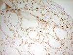 MEF2D Antibody in Immunohistochemistry (Paraffin) (IHC (P))