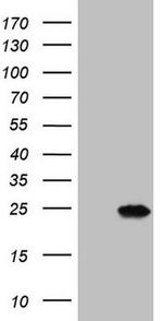 MYL4 Antibody in Western Blot (WB)