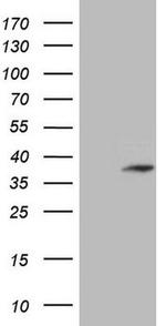 TCEAL1 Antibody in Western Blot (WB)