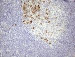 CDCA8 Antibody in Immunohistochemistry (Paraffin) (IHC (P))