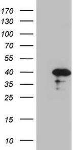 CDCA8 Antibody in Western Blot (WB)